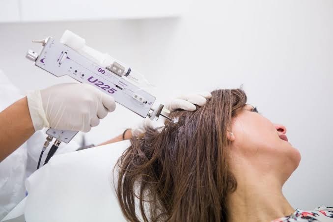 What are the pros and cons of mesotherapy for hair growth?