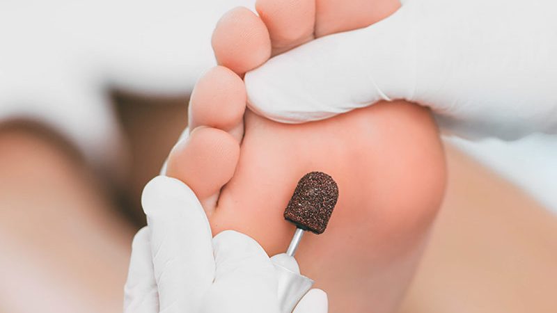 Stem Cell Therapy Treats Common Foot and Ankle Injuries